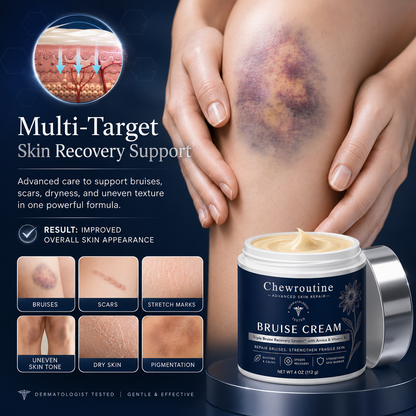 💥100K+ SOLD💕- ChewRoutine® Bruise Repair & Skin-Strengthening Cream