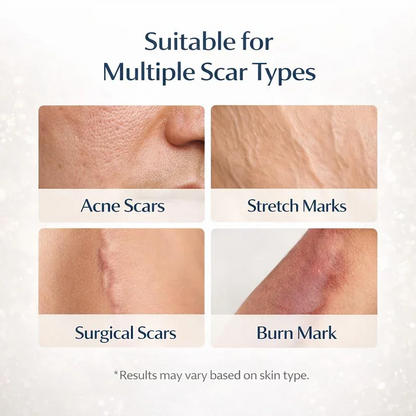 Fempick Scar Smooth – Great Care Cream for All Types of Skin Marks 🧴