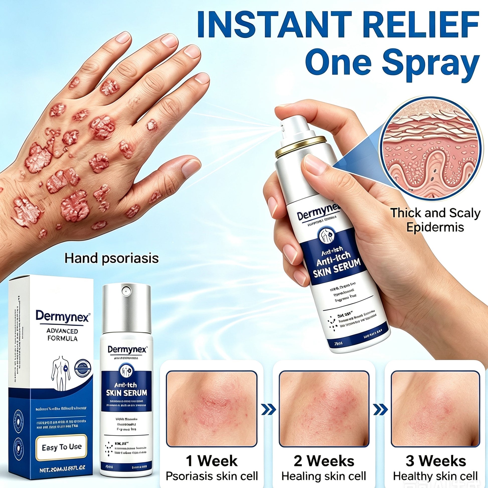 Dermynex™ Psoriasis & Eczema Relief Spray — Advanced Skin Recovery Mist with Bee Venom & Omega-3