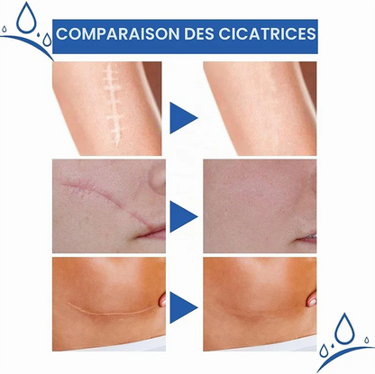 Fempick Scar Smooth – Great Care Cream for All Types of Skin Marks 🧴