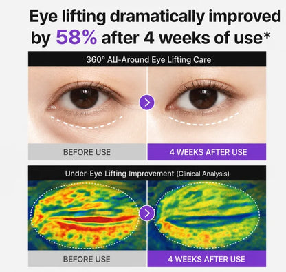 Elorysa 360° Eye Cream – Instant Dark Circle Brightener & Rapid Anti-Puffiness & 360° Firming Wrinkle Reducer